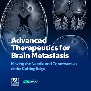 2026 Advanced Therapeutics for Brain Metastasis: Moving the Needle and Controversies at the Cutting Edge Banner