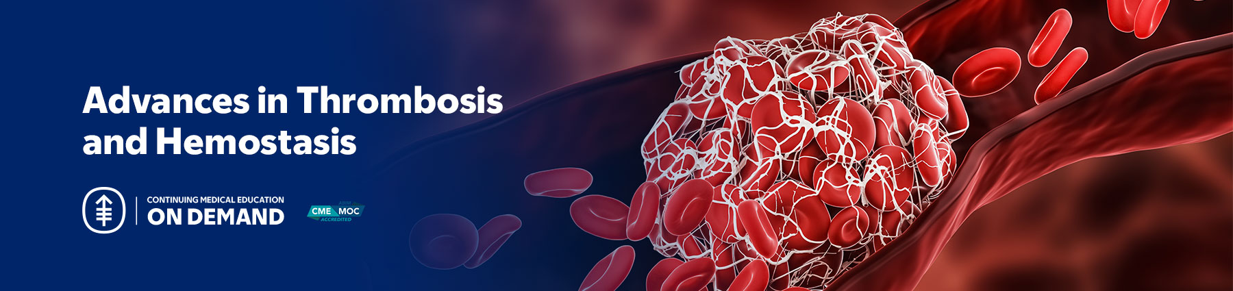 Advances in Thrombosis and Hemostasis — On Demand Banner