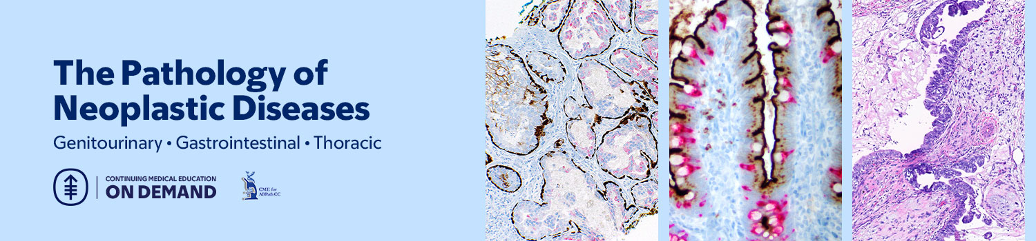 The Pathology of Neoplastic Diseases 2026 — On Demand Banner