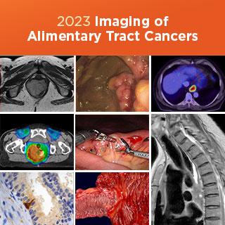 2023 Imaging of Alimentary Tract Cancers: Challenges and Opportunities in the Multidisciplinary Management of GI Cancers Banner
