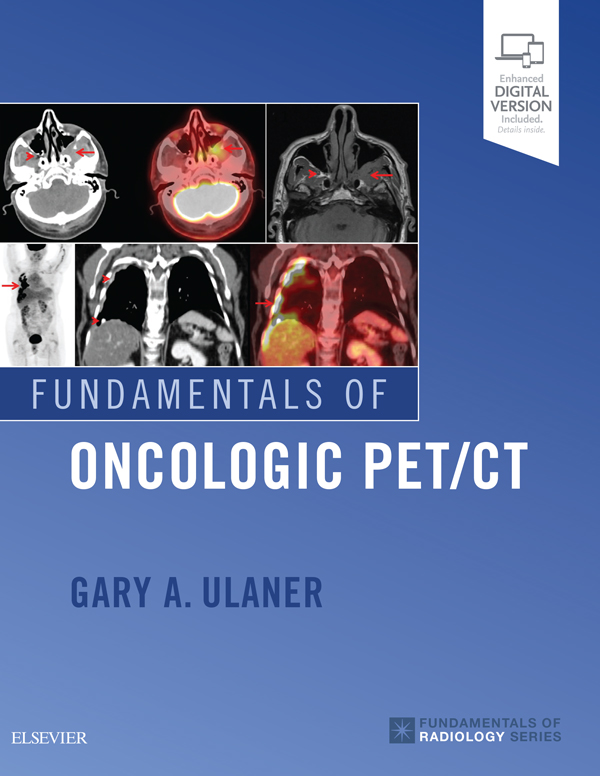 Fundamentals of Oncologic PET/CT 