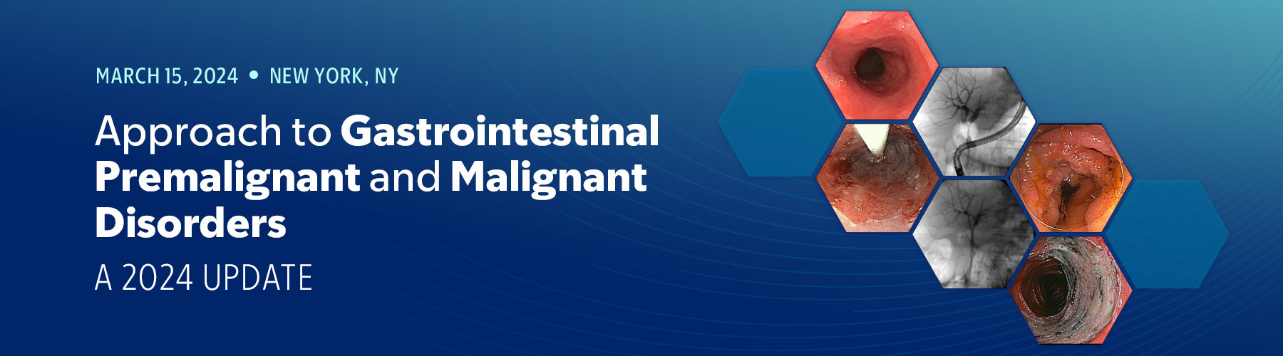 Approach to Gastrointestinal Premalignant and Malignant Disorders: A 2024 Update Banner