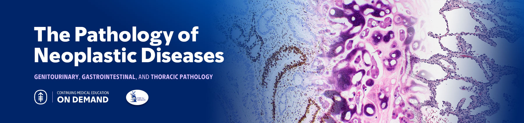 The Pathology of Neoplastic Diseases 2024 — On Demand Banner