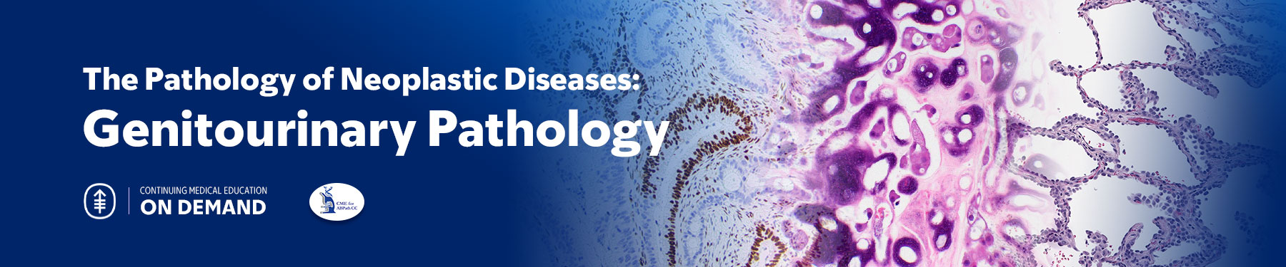 Genitourinary Pathology — The Pathology of Neoplastic Diseases 2024 On Demand Banner