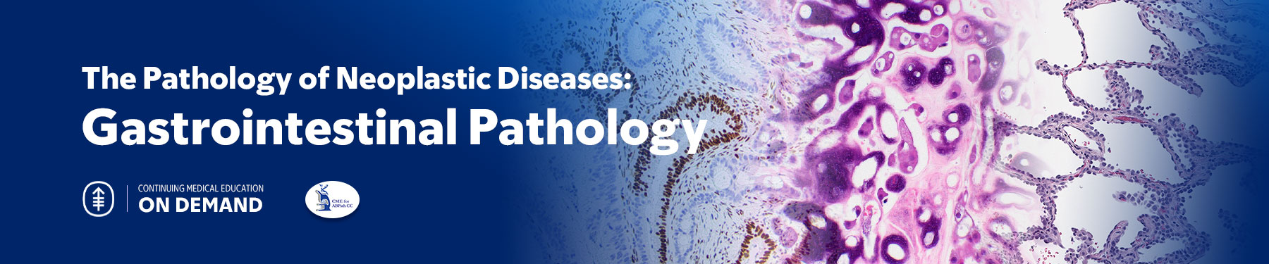 Gastrointestinal Pathology — The Pathology of Neoplastic Diseases 2024 On Demand Banner