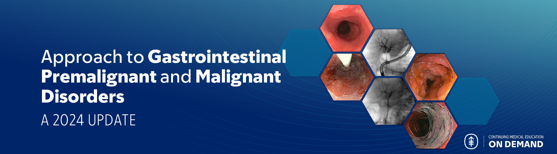 Approach to Gastrointestinal Premalignant and Malignant Disorders: A 2024 Update - On Demand Banner