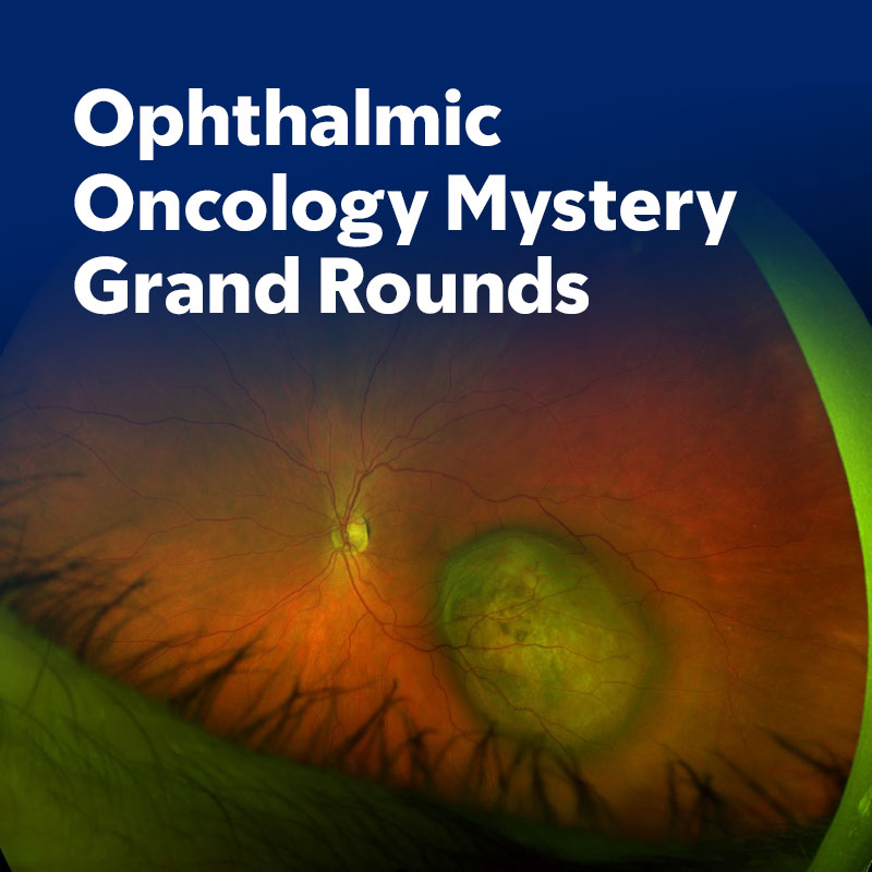 Ophthalmic Oncology Mystery Grand Rounds Banner