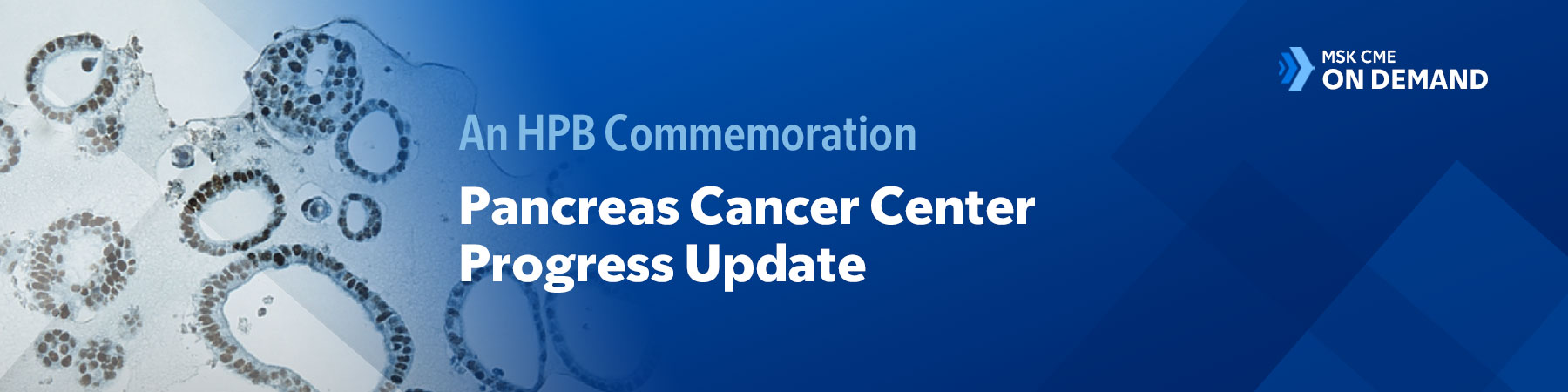 An HPB Commemoration: Pancreas Cancer Center Progress Update — On Demand Banner